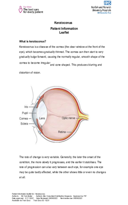 Keratoconus  v4